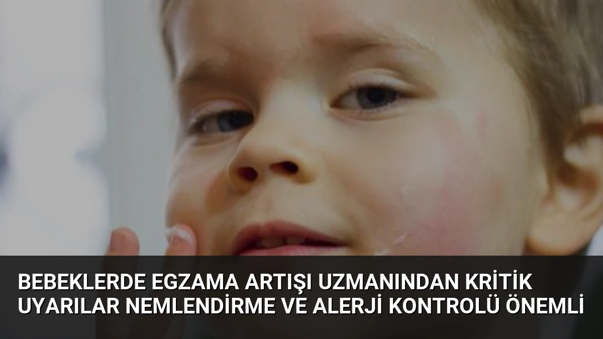 Bebeklerde Egzama Artışı Uzmanından Kritik Uyarılar Nemlendirme ve Alerji Kontrolü Önemli