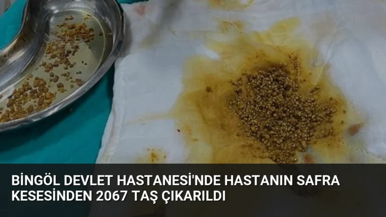 Bingöl Devlet Hastanesi’nde Hastanın Safra Kesesinden 2067 Taş Çıkarıldı