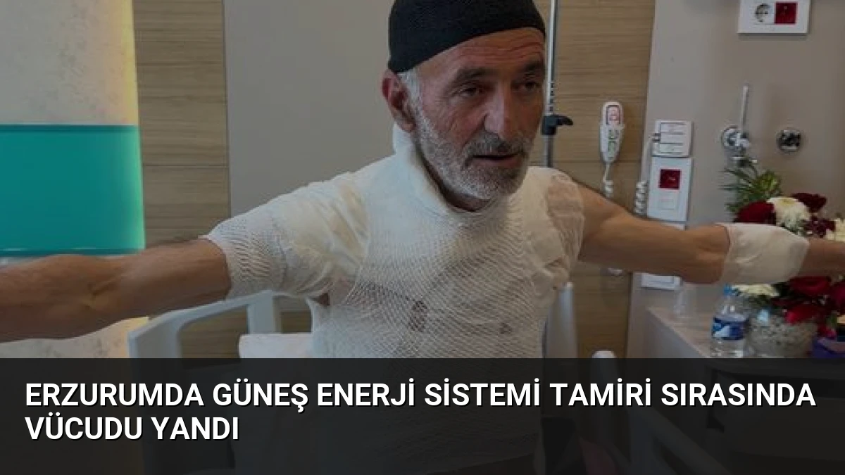 Erzurumda Güneş Enerji Sistemi Tamiri Sırasında Vücudu Yandı