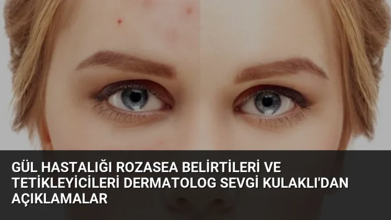 Gül Hastalığı Rozasea Belirtileri ve Tetikleyicileri Dermatolog Sevgi Kulaklı’dan Açıklamalar