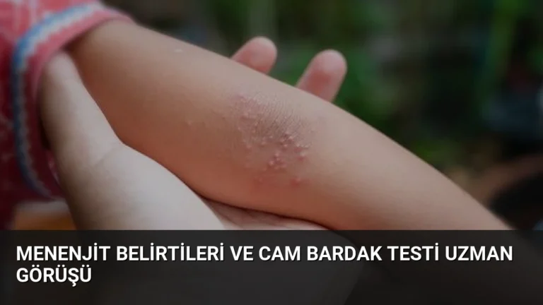 Menenjit Belirtileri ve Cam Bardak Testi Uzman Görüşü