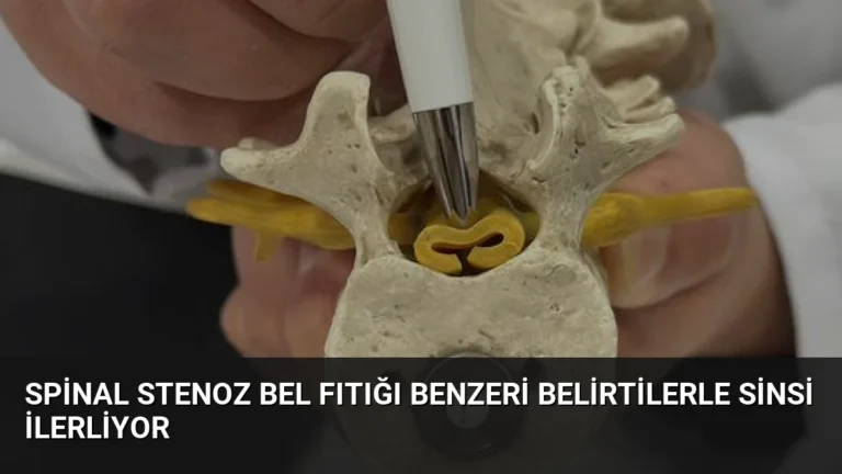 Spinal Stenoz Bel Fıtığı Benzeri Belirtilerle Sinsi İlerliyor