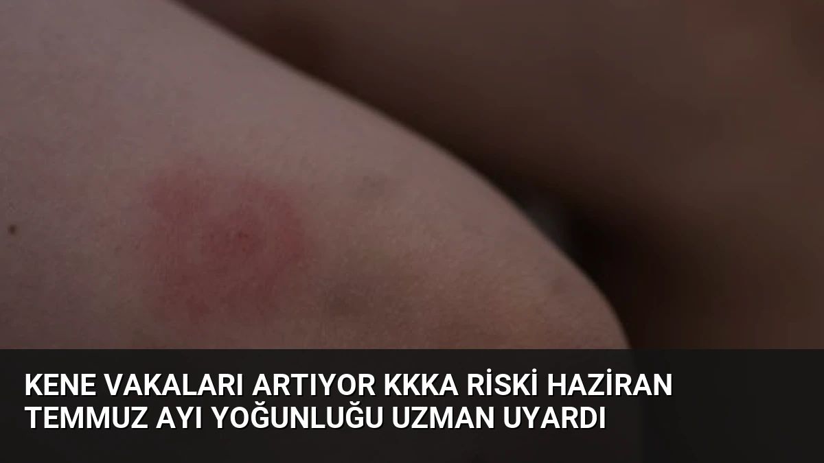 Kene Vakaları Artıyor KKKA Riski Haziran Temmuz Ayı Yoğunluğu Uzman Uyardı